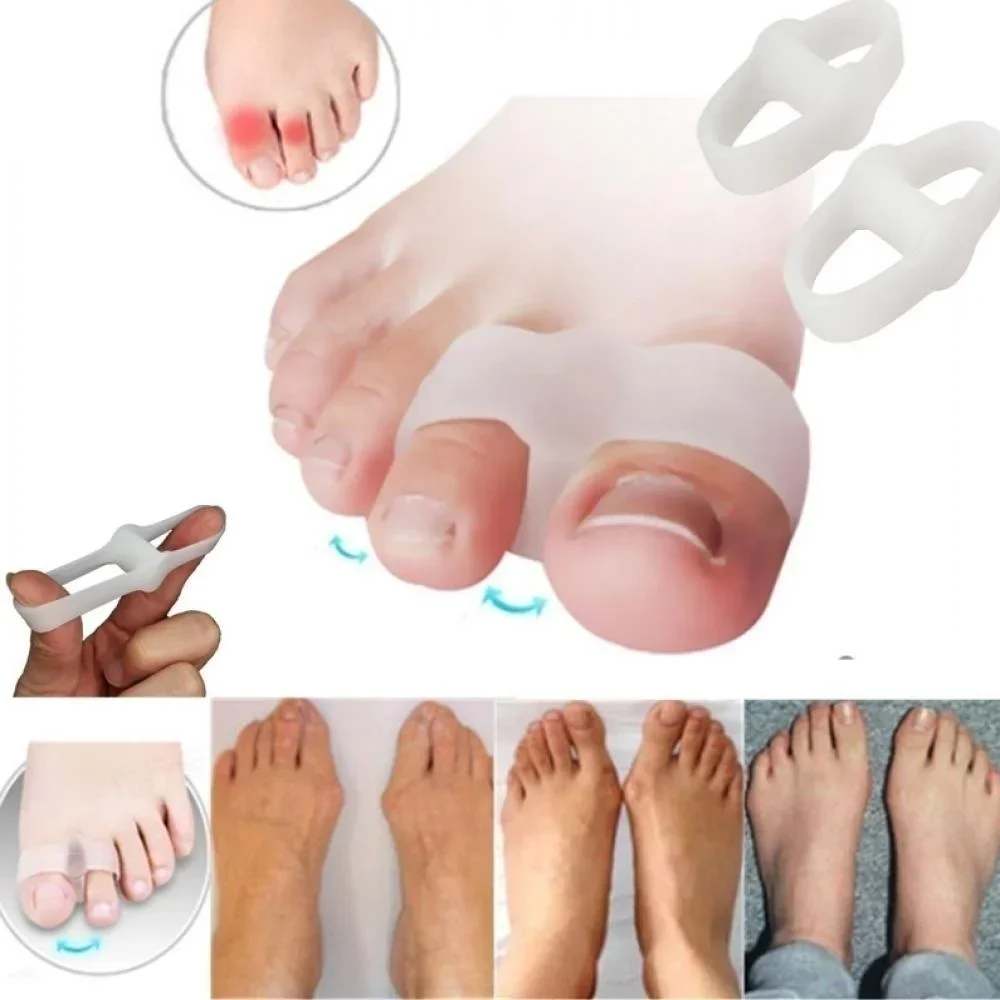 2 Holes Bunion Corrector Pain  - Correction Fluid White ulasan dan harga